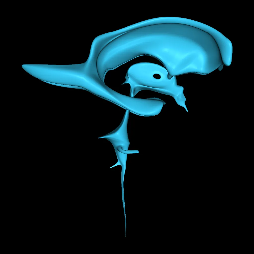 Cerebro (Ventrículos – aislados), vista lateral