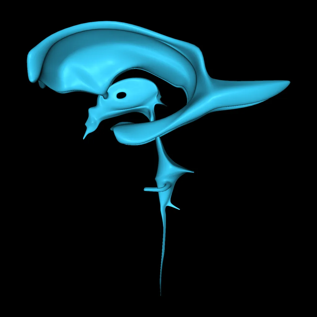 Cerebro (Ventrículos – aislados), vista medial